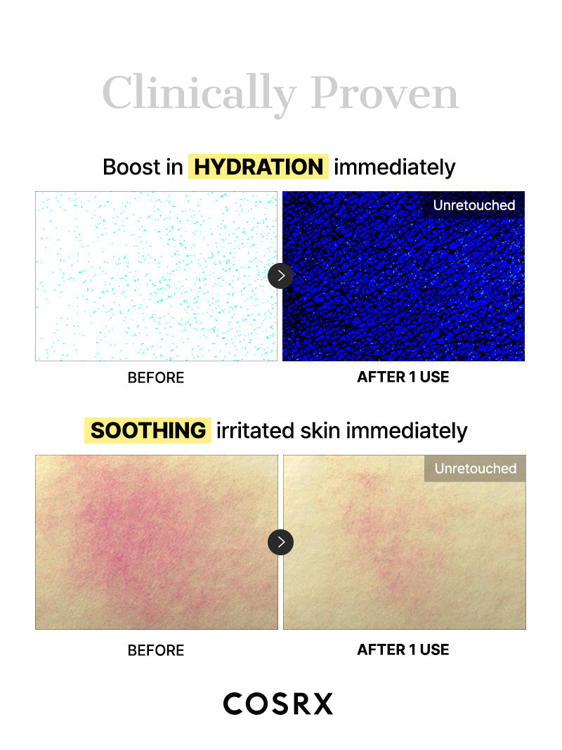 Advanced Snail Mucin Glass Glow Hydrogel Mask